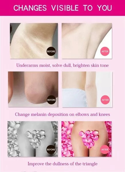 Underarm™ - Crema Aclarante partes intimas y otras zonas oscuras del cuerpo